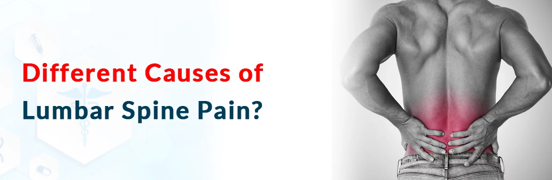  Different Causes of Lumbar Spine Pain?